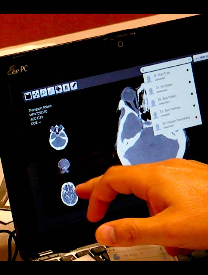 A radiologist's finger points at a simulated patient image in our software prototype as shown loaded on a laptop